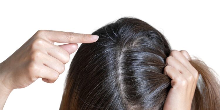 Créditos: Reprodução/ L'Oréal Paris